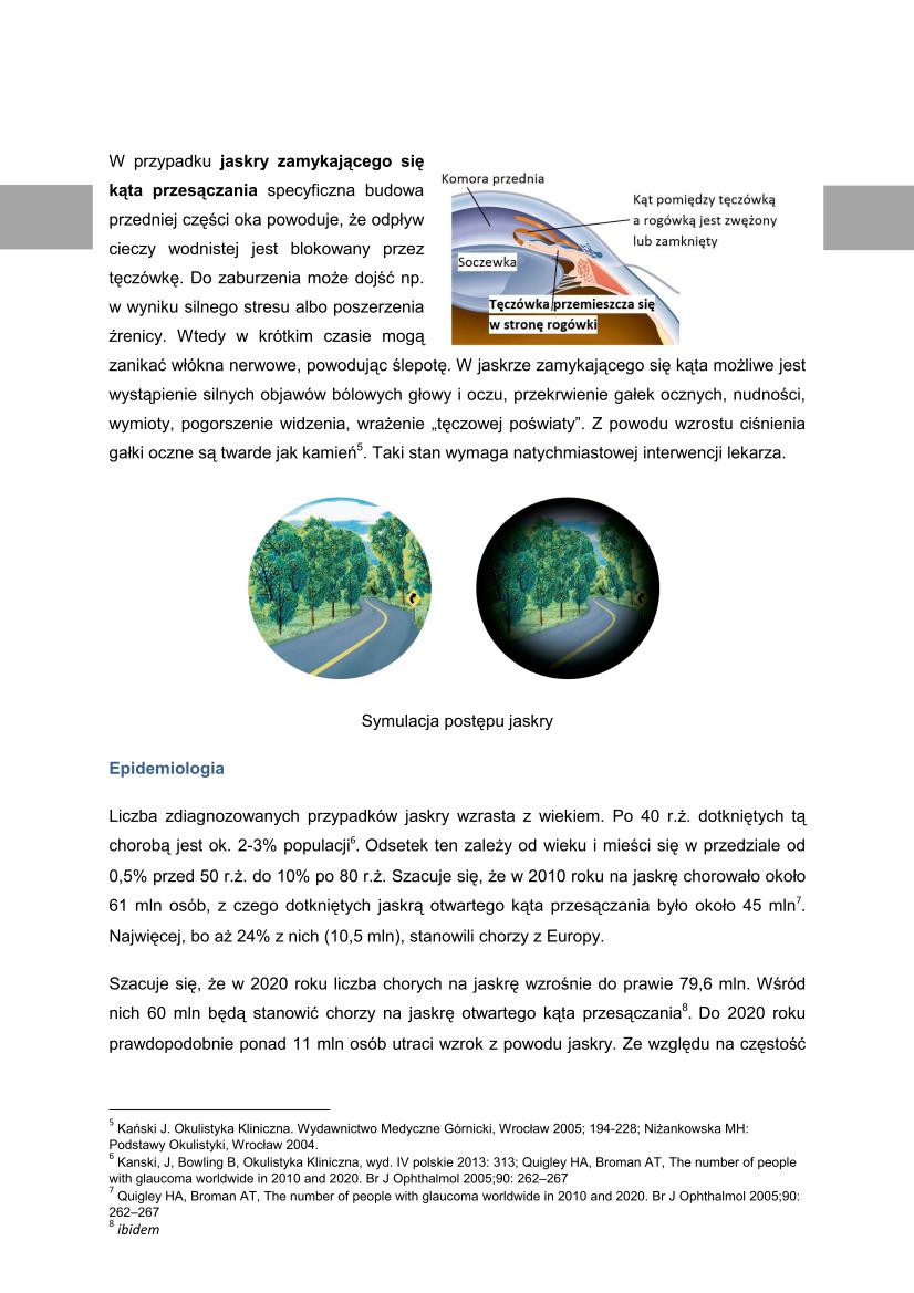 Microsoft Word Viewer - Jaskra - podstawowe informacje o problemie_03