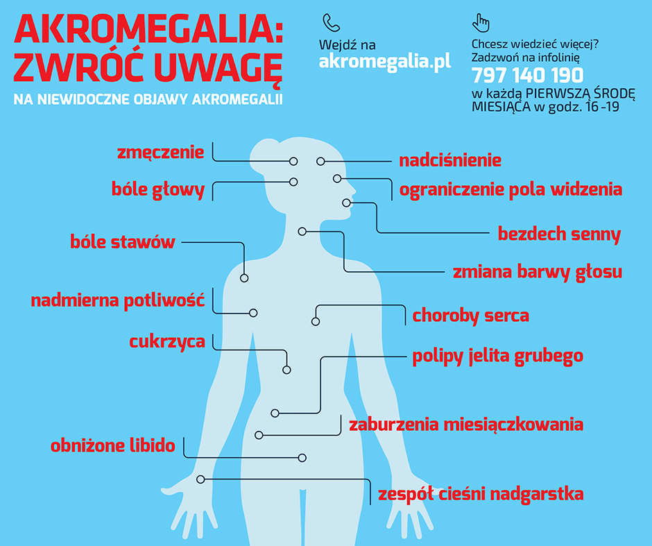 AKROMEGALIA – GDY DOROSŁY ZACZYNA ROSNĄĆ